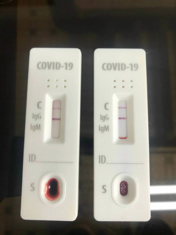Phương án xét nghiệm kháng thể để xác định người đã mắc COVID-19 sẽ không được TPHCM thực hiện